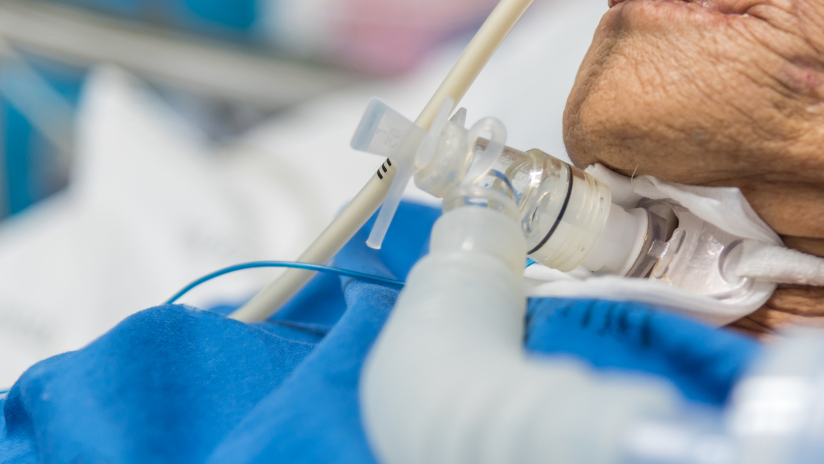 Ventilation and Airway Management Apollo Home Healthcare